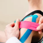 kinesio taping